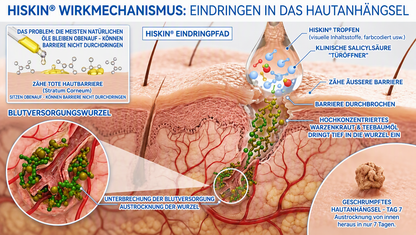 𝐇𝐢𝐬𝐤𝐢𝐧®  2-in-1 Advanced schmerzfreie narbenfreie Hautreparaturcreme – gegen Hautwucherungen, Warzen und sichtbare Hautmakel