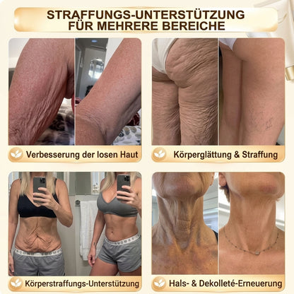 HISKIN® Nano-Mikronadel-Pflaster für mehr Brustvolumen, Lifting & Straffung – Volufiline-, Exosomen- und Kupferpeptid-Formel mit Zell-Erneuerungstechnologie