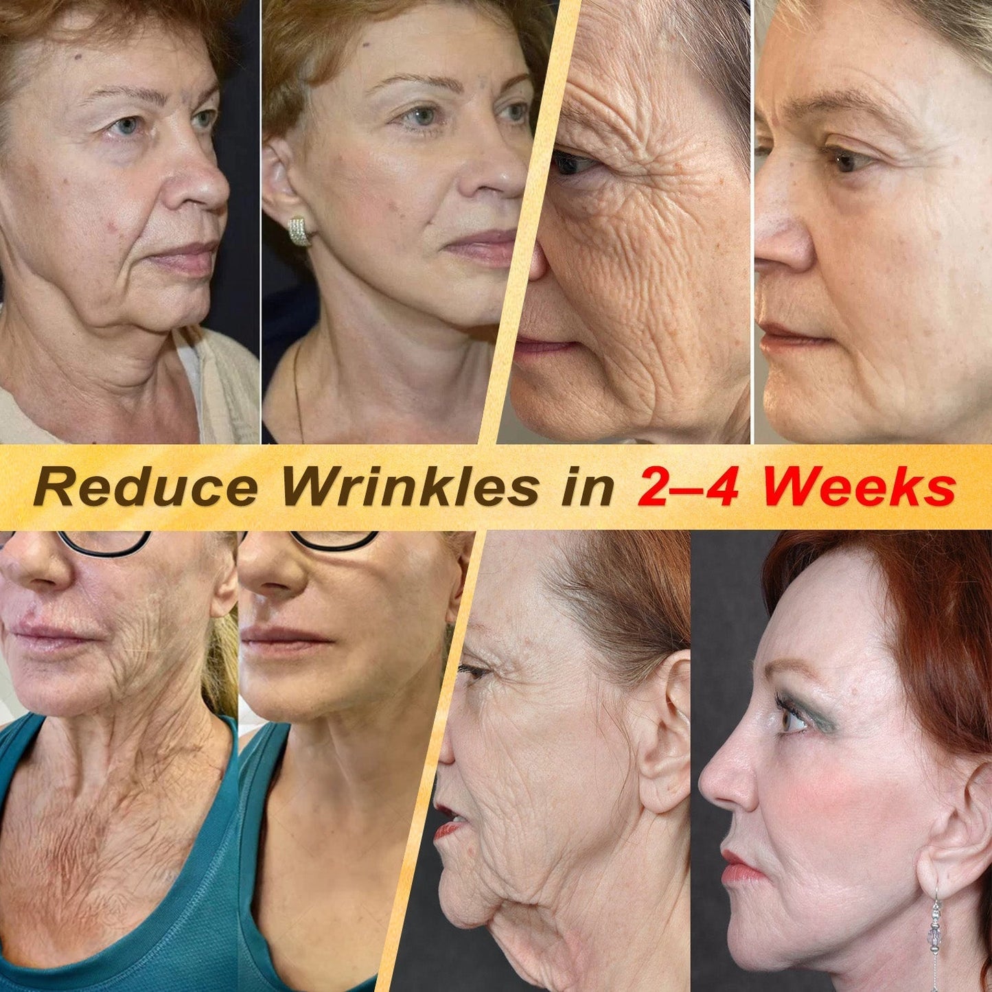 HISKIN® Multi-Concern Skin Repair Cream (One powerful cream to repair inflammation, dryness, aging, pigmentation, and visible skin damage.)