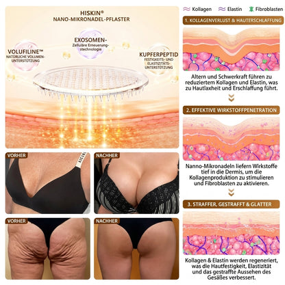 HISKIN® Nano-Mikronadel-Pflaster für mehr Brustvolumen, Lifting & Straffung – Volufiline-, Exosomen- und Kupferpeptid-Formel mit Zell-Erneuerungstechnologie