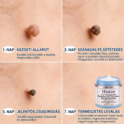 XYL-𝐇𝐢𝐬𝐤𝐢𝐧® 2 az 1-ben fejlett, fájdalommentes és hegmentes bőrmegújító krém – bőrkinövések, szemölcsök és látható bőrhibák ellen